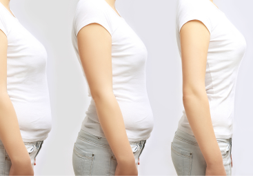 Trendy v plastické chirurgii 2026: vliv léků na hubnutí